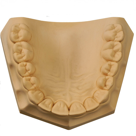 Gypsum Dental Stone Yellow 5Kg